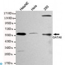 GATA6 Antibody - Western blot detection of GATA6 in HelaNE, Hela and 293 cell lysates and using GATA6 mouse mAb (1:200 diluted). Predicted band size: 45KDa. Observed band size: 60KDa.