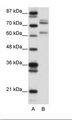 GATAD2B Antibody - A: Marker, B: 293T Cell Lysate.  This image was taken for the unconjugated form of this product. Other forms have not been tested.