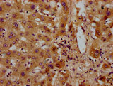 GATB / PET112 Antibody - Immunohistochemistry Dilution at 1:300 and staining in paraffin-embedded human liver tissue performed on a Leica BondTM system. After dewaxing and hydration, antigen retrieval was mediated by high pressure in a citrate buffer (pH 6.0). Section was blocked with 10% normal Goat serum 30min at RT. Then primary antibody (1% BSA) was incubated at 4°C overnight. The primary is detected by a biotinylated Secondary antibody and visualized using an HRP conjugated SP system.