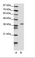 GAX / MEOX2 Antibody - A: Marker, B: Transfected 293T Cell Lysate.  This image was taken for the unconjugated form of this product. Other forms have not been tested.