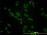 GBA / Glucosidase Beta Acid Antibody - Immunofluorescence of monoclonal antibody to GBA on HeLa cell (antibody concentration 10 ug/ml).