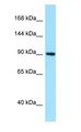 GBE1 Antibody - GBE1 antibody Western Blot of HepG2.  This image was taken for the unconjugated form of this product. Other forms have not been tested.