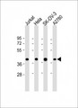 GBGT1 Antibody - All lanes: Anti-GBGT1 Antibody (Center) at 1:2000 dilution Lane 1: Jurkat whole cell lysate Lane 2: Hela whole cell lysate Lane 3: SK-OV-3 whole cell lysate Lane 4: A2780 whole cell lysate Lysates/proteins at 20 µg per lane. Secondary Goat Anti-Rabbit IgG, (H+L), Peroxidase conjugated at 1/10000 dilution. Predicted band size: 40 kDa Blocking/Dilution buffer: 5% NFDM/TBST.