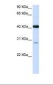 GCD / GCDH Antibody - 293T cell lysate. Antibody concentration: 1.0 ug/ml. Gel concentration: 12%.  This image was taken for the unconjugated form of this product. Other forms have not been tested.