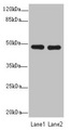 GCM1 Antibody - Western blot All Lanes: GCM1antibody at 0.97ug/ml Lane 1: Hela whole cell lysate Lane 2: HepG-2 whole cell lysate Secondary Goat polyclonal to Rabbit IgG at 1/10000 dilution Predicted band size: 49 kDa Observed band size: 49 kDa