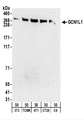 GCN1 / GCN1L1 Antibody - Detection of Mouse and Rat GCN1L1 by Western Blot. Samples: Whole cell lysate (50 ug) from NIH3T3, TCMK-1, 4T1, CT26.WT, and rat C6 cells. Antibodies: Affinity purified rabbit anti-GCN1L1 antibody used for WB at 0.5 ug/ml. Detection: Chemiluminescence with an exposure time of 3 minutes.