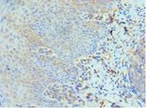 GCN2 Antibody - Immunohistochemistry of paraffin-embedded human tonsil tissue using antibody at 1:100 dilution.