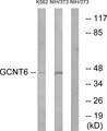 GCNT6 Antibody - Western blot analysis of lysates from NIH/3T3 and K562 cells, using GCNT6 Antibody. The lane on the right is blocked with the synthesized peptide.