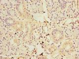 GDAP1L1 Antibody - Immunohistochemistry of paraffin-embedded human pancreatic tissue using antibody at dilution of 1:100.