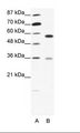 GDI1 Antibody - A: Marker, B: HepG2 Cell Lysate.  This image was taken for the unconjugated form of this product. Other forms have not been tested.