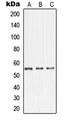 GDI1 Antibody - Western blot analysis of GDI1 expression in HepG2 (A); U87MG (B); SHSY5Y (C) whole cell lysates.