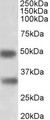 GEM / KIR Antibody - GEM antibody (1 ug/ml) staining of Human Spleen lysate (35 ug protein in RIPA buffer). Primary incubation was 1 hour. Detected by chemiluminescence.