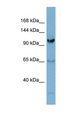 GEMIN4 Antibody - GEMIN4 antibody Western blot of Jurkat lysate. This image was taken for the unconjugated form of this product. Other forms have not been tested.