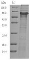 Glycerol-1-phosphate dehydrogenase [NAD(P)+] (egsA) Protein - (Tris-Glycine gel) Discontinuous SDS-PAGE (reduced) with 5% enrichment gel and 15% separation gel.