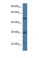 GFAP Antibody - GFAP antibody Western blot of Mouse Thymus lysate. Antibody concentration 1 ug/ml. This image was taken for the unconjugated form of this product. Other forms have not been tested.