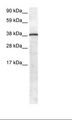 GFI1 Antibody - Fetal Lung Lysate.  This image was taken for the unconjugated form of this product. Other forms have not been tested.