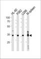GFI1B Antibody - GFI1B Antibody western blot of HL-60,K562,U266 cell line and mouse spleen lysates (35 ug/lane). The GFI1B antibody detected the GFI1B protein (arrow).