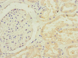 GFM2 Antibody - Immunohistochemistry of paraffin-embedded human kidney tissue at dilution 1:100