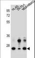 GFRA4 Antibody - GFRA4 Antibody western blot of HL-60,ZR-75-1,MDA-MB453 cell line lysates (35 ug/lane). The GFRA4 antibody detected the GFRA4 protein (arrow).