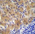 GGH / Gamma-Glutamyl Hydrolase Antibody - GGH Antibody immunohistochemistry of formalin-fixed and paraffin-embedded human liver tissue followed by peroxidase-conjugated secondary antibody and DAB staining.