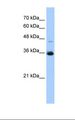 GGPS1 Antibody - HepG2 cell lysate. Antibody concentration: 0.25 ug/ml. Gel concentration: 12%.  This image was taken for the unconjugated form of this product. Other forms have not been tested.