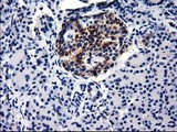 GGPS1 Antibody - Immunohistochemical staining of paraffin-embedded Human pancreas tissue using anti-GGPS1 mouse monoclonal antibody.