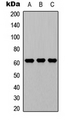 GGT1 / GGT Antibody - Western blot analysis of CD224 LC expression in A549 (A); NS-1 (B); PC12 (C) whole cell lysates.