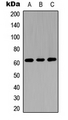 GGTLA1 / GGT5 Antibody - Western blot analysis of GGT5 HC expression in A549 (A); NS-1 (B); H9C2 (C) whole cell lysates.