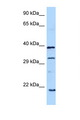 GH / Growth Hormone Antibody - GH1 / Growth Hormone antibody Western blot of 1 Cell lysate. Antibody concentration 1 ug/ml.  This image was taken for the unconjugated form of this product. Other forms have not been tested.