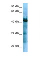 GHSR / Ghrelin Receptor Antibody - GHSR / Ghrelin Receptor antibody Western blot of ACHN Cell lysate. Antibody concentration 1 ug/ml.  This image was taken for the unconjugated form of this product. Other forms have not been tested.