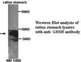 GHSR / Ghrelin Receptor Antibody