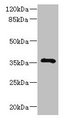 GIMAP7 Antibody - Western blot All lanes: GIMAP7 antibody at 2µg/ml + Jurkat whole cell lysate Secondary Goat polyclonal to rabbit IgG at 1/10000 dilution Predicted band size: 35 kDa Observed band size: 35 kDa