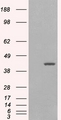 GIPC1 / GIPC Antibody - HEK293 overexpressing GIPC1 isoform 1 (RC216466) and probed with (mock transfection in first lane).