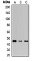 GJA3 / CX46 / Connexin 46 Antibody - Western blot analysis of Connexin 46 expression in HEK293T (A); Raw264.7 (B); H9C2 (C) whole cell lysates.