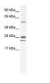 GJB2 / CX26 / Connexin 26 Antibody - Fetal Lung Lysate.  This image was taken for the unconjugated form of this product. Other forms have not been tested.