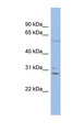 GJB6 / CX30 / Connexin 30 Antibody - GJB6 antibody Western blot of THP-1 cell lysate. This image was taken for the unconjugated form of this product. Other forms have not been tested.
