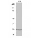 GJB7 / CX25 / Connexin 25 Antibody - Western blot of Connexin 25 antibody