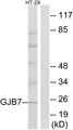 GJB7 / CX25 / Connexin 25 Antibody - Western blot analysis of lysates from HT-29 cells, using GJB7 Antibody. The lane on the right is blocked with the synthesized peptide.