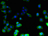 GJB7 / CX25 / Connexin 25 Antibody - Immunofluorescent analysis of A431 cells using GJB7 Antibody at dilution of 1:100 and Alexa Fluor 488-congugated AffiniPure Goat Anti-Rabbit IgG(H+L)