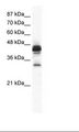 GJC3 / GJE1 Antibody - Jurkat Cell Lysate.  This image was taken for the unconjugated form of this product. Other forms have not been tested.