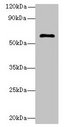 GK5 Antibody - Western blot All lanes: GK5 antibody at 4µg/ml + K562 whole cell lysate Secondary Goat polyclonal to rabbit IgG at 1/10000 dilution Predicted band size: 60, 34, 28 kDa Observed band size: 60 kDa