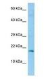 GKN2 / Gastrokine 2 Antibody - GKN2 antibody Western Blot of Fetal Brain.  This image was taken for the unconjugated form of this product. Other forms have not been tested.