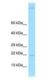 GKN2 / Gastrokine 2 Antibody - GKN2 antibody Western Blot of Fetal Liver.  This image was taken for the unconjugated form of this product. Other forms have not been tested.