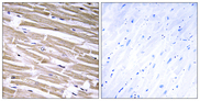 GLCT2 / B3GALT2 Antibody - Immunohistochemistry analysis of paraffin-embedded human heart tissue, using B3GALT2 Antibody. The picture on the right is blocked with the synthesized peptide.