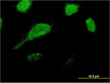 GLE1 Antibody - Immunofluorescence of monoclonal antibody to GLE1 on HeLa cell . [antibody concentration 10 ug/ml]