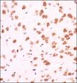 GLI / GLI1 Antibody - Immunohistochemistry: Gli1 Antibody - IHC of Gli1 in mouse brain using DAB with hematoxylin counterstain.  This image was taken for the unconjugated form of this product. Other forms have not been tested.