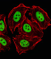 GLI2 Antibody - Fluorescent image of HeLa cells stained with GLI2 Antibody. Antibody was diluted at 1:25 dilution. An Alexa Fluor 488-conjugated goat anti-rabbit lgG at 1:400 dilution was used as the secondary antibody (green). Cytoplasmic actin was counterstained with Alexa Fluor 555 conjugated with Phalloidin (red).