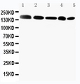 GLI2 Antibody - WB of GLI2 antibody. Lane 1: MCF-7 Cell Lysate. Lane 2: HELA Cell Lysate. Lane 3: SKOV Cell Lysate. Lane 4: HT1080 Cell Lysate. Lane 5: A549 Cell Lysate..