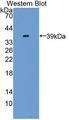 GLI3 Antibody - Western Blot; Sample: Recombinant GLI3, Mouse.