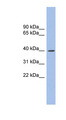 GLI4 Antibody - GLI4 antibody Western blot of Fetal Stomach lysate. This image was taken for the unconjugated form of this product. Other forms have not been tested.